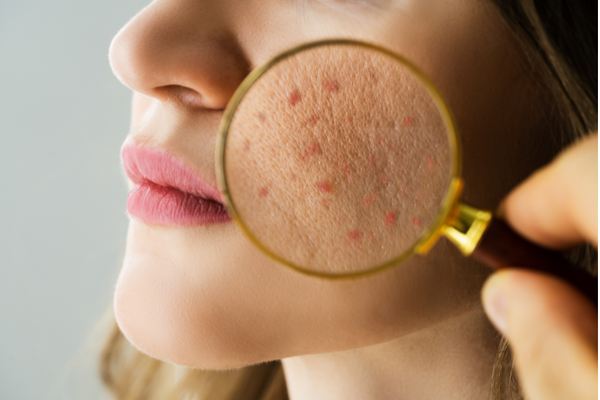 Dermatology_600x400