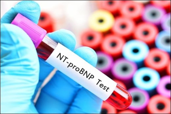NT_proBNP_600x400