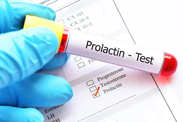 Prolactin_600x400