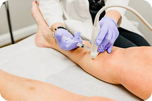 Radiofrequency