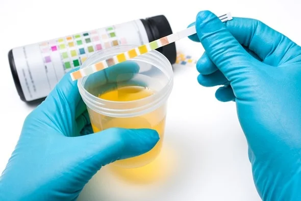 Urine_Analysis_600x400