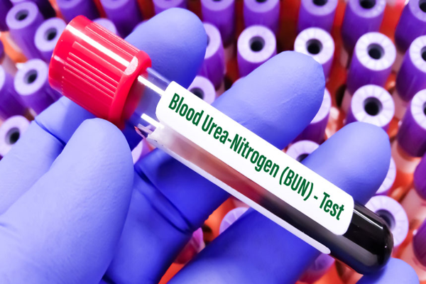 blood ureaa